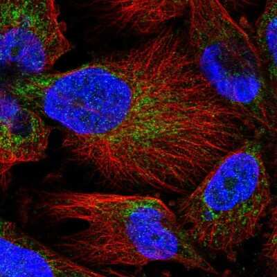 Immunocytochemistry/ Immunofluorescence: MARCH5 Antibody [NBP2-56779]