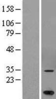 Western Blot: MARCH5 Overexpression Lysate [NBL1-07000]