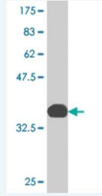 Western Blot: MARCH6 Antibody (1A5) [H00010299-M05]