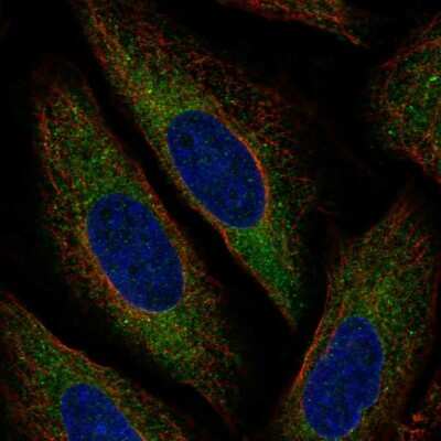 Immunocytochemistry/ Immunofluorescence: MARCH6 Antibody [NBP2-58931]