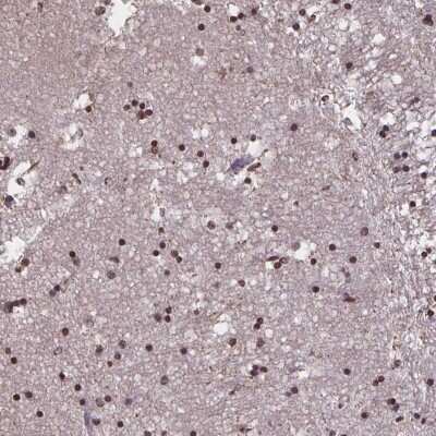 Immunohistochemistry: MARCH6 Antibody [NBP2-38987]