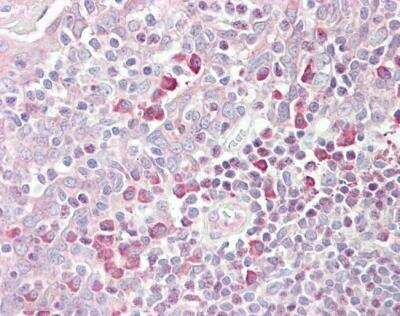 Immunohistochemistry-Paraffin: MARCH6 Antibody [NBP1-06088]