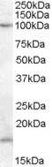 Western Blot: MARCH6 Antibody [NB100-93441]