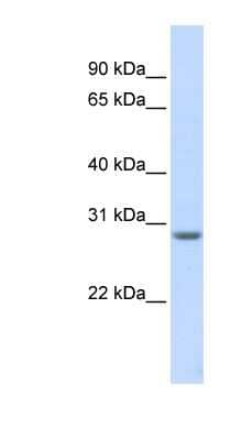 Western Blot: MARCH8 Antibody [NBP1-59515]