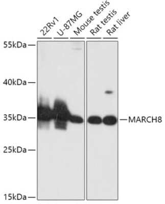 Western Blot: MARCH8 AntibodyAzide and BSA Free [NBP2-92098]