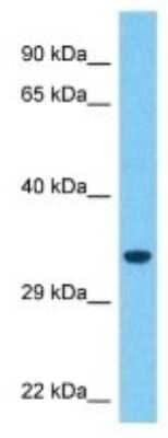 Western Blot: MARCH8 Antibody [NBP3-09974]