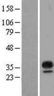 Western Blot: MARCH8 Overexpression Lysate [NBL1-07136]