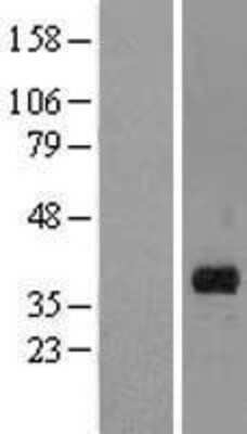 Western Blot: MARCH8 Overexpression Lysate [NBL1-07137]