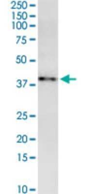 Western Blot: MARCH9 Antibody (2B5) [H00092979-M01]