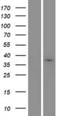 Western Blot: MARCH9 Overexpression Lysate [NBP2-05669]