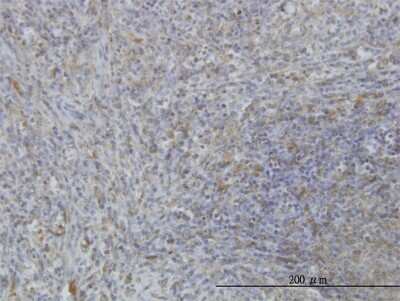 Immunohistochemistry-Paraffin: MARCKS Antibody (2C2) [H00004082-M06]