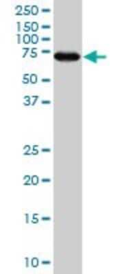 Western Blot: MARCKS Antibody (2H4) [H00004082-M04]