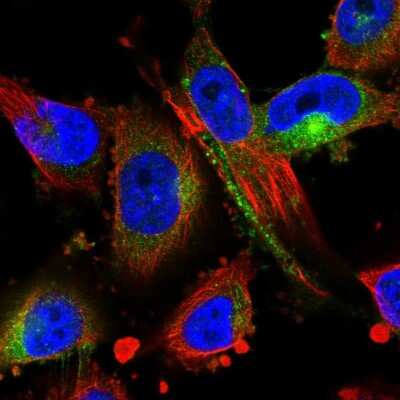 Immunocytochemistry/ Immunofluorescence: MARCKS Antibody [NBP2-58267]