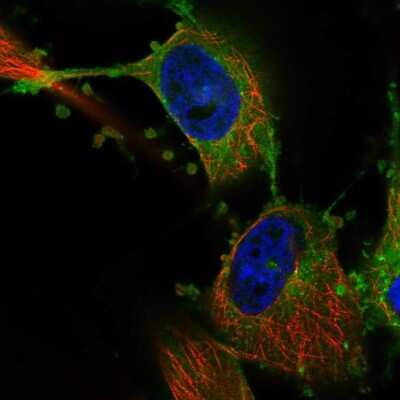 Immunocytochemistry/ Immunofluorescence: MARCKS Antibody [NBP2-68861]