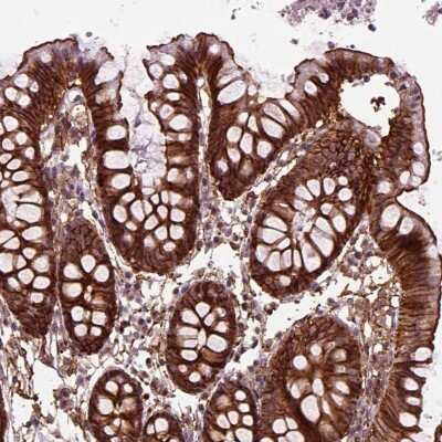 Immunocytochemistry/ Immunofluorescence: MARCKS Antibody [NBP2-68861]