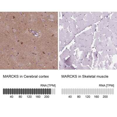 Immunohistochemistry-Paraffin: MARCKS Antibody [NBP2-62663]