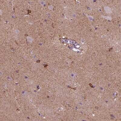 Immunohistochemistry-Paraffin: MARCKS Antibody [NBP2-62663]