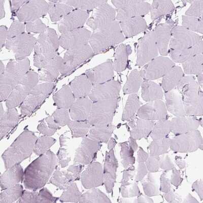 Immunohistochemistry-Paraffin: MARCKS Antibody [NBP2-62663]