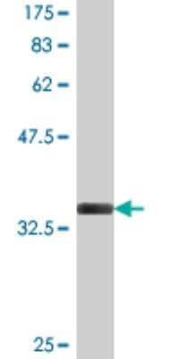 Western Blot: MARCKS like protein Antibody (2H5) [H00065108-M03]