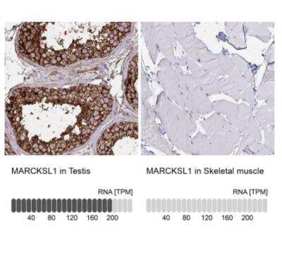 Immunohistochemistry-Paraffin: MARCKS like protein Antibody [NBP2-38160]