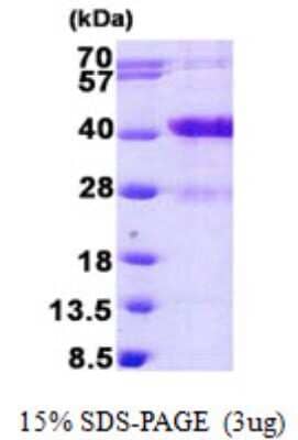 SDS-PAGE: Recombinant Human MARCKS like protein His Protein [NBP2-23217]