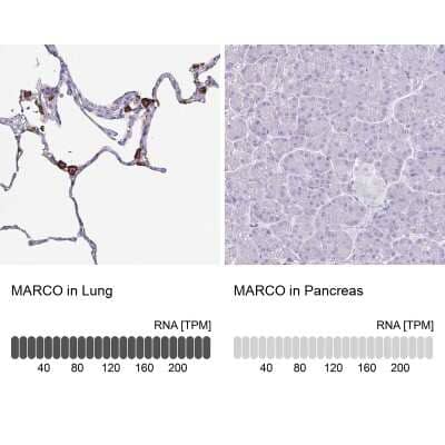 Immunohistochemistry-Paraffin: MARCO Antibody [NBP2-39004]