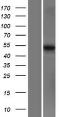 Western Blot: MARCO Overexpression Lysate [NBP2-07582]