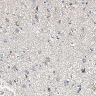 Immunohistochemistry-Paraffin: MARK1 Antibody [NBP1-82799]