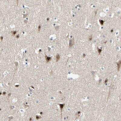 Immunohistochemistry-Paraffin: MARK1 Antibody [NBP1-82800]