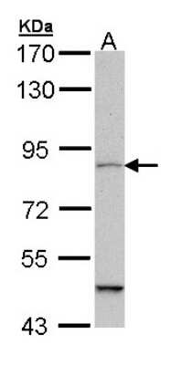 Western Blot: MARK1 Antibody [NBP1-33409]