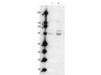 Western Blot: MARK2 [p Thr595] Antibody [NBP1-78028]