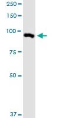 Western Blot: MARK2 Antibody (3B12) [H00002011-M01]