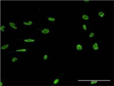 Immunocytochemistry/ Immunofluorescence: MARK2 Antibody (3C5) [H00002011-M02]