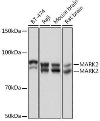 Western Blot: MARK2 Antibody (6O1C2) [NBP3-16636]