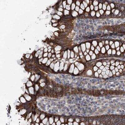 Immunohistochemistry-Paraffin: MARK2 Antibody [NBP1-84848]