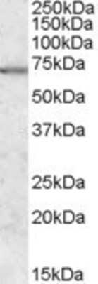 Western Blot: MARK2 Antibody [NBP1-00214]