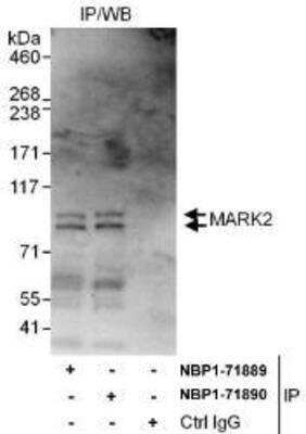 Western Blot: MARK2 Antibody [NBP1-71889]