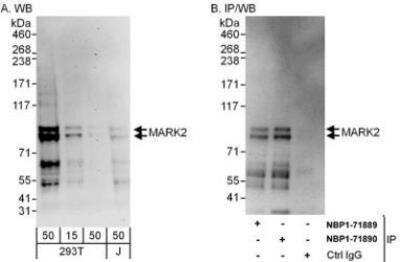 Western Blot: MARK2 Antibody [NBP1-71890]