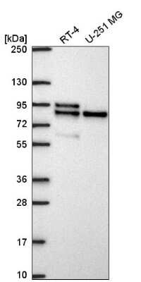 Western Blot: MARK2 Antibody [NBP2-57851]