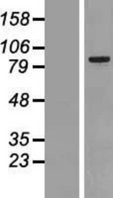 Western Blot: MARK2 Overexpression Lysate [NBP2-06979]