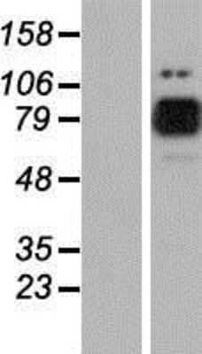 Western Blot: MARK2 Overexpression Lysate [NBP2-07807]