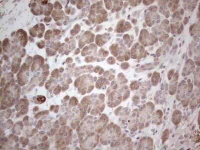 Immunohistochemistry: MARK4 Antibody (OTI9B7) [NBP2-45755]