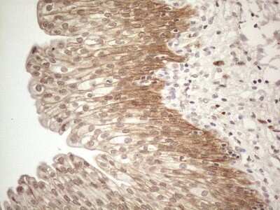 Immunohistochemistry: MARK4 Antibody (OTI9B7) [NBP2-45755]