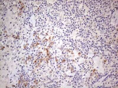 Immunohistochemistry: MARK4 Antibody (OTI9B7) [NBP2-45755]
