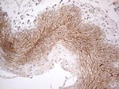 Immunohistochemistry: MARK4 Antibody (OTI9B7) [NBP2-45755]