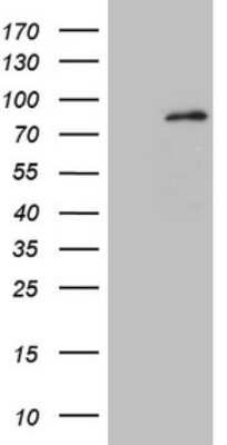 Western Blot: MARK4 Antibody (OTI9B7) [NBP2-45755]