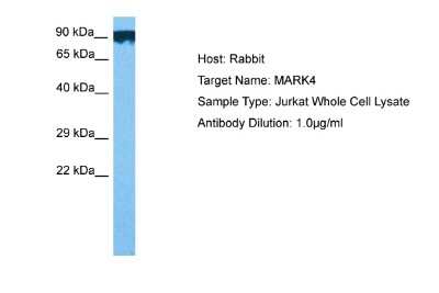 Western Blot: MARK4 Antibody [NBP2-87777]