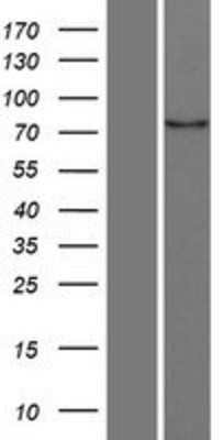 Western Blot: MARK4 Overexpression Lysate [NBL1-12900]