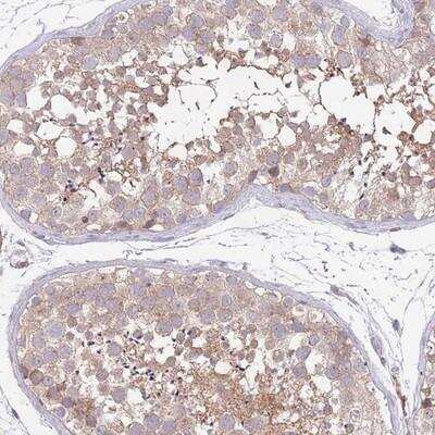 Immunohistochemistry: MARVELD2 Antibody [NBP2-14222]