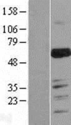 Western Blot: MARVELD2 Overexpression Lysate [NBL1-12902]